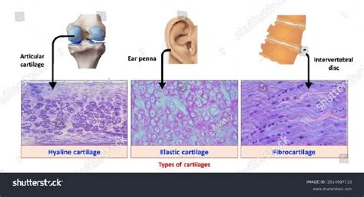 Does articular cartilage contain hyaline cartilage?