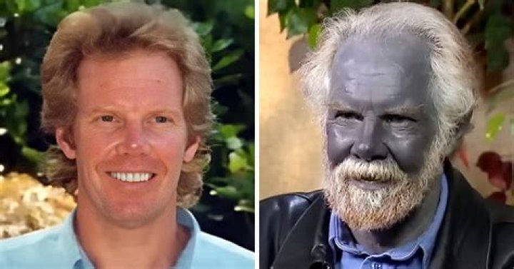 What happened to the guy who turned blue colloidal silver?