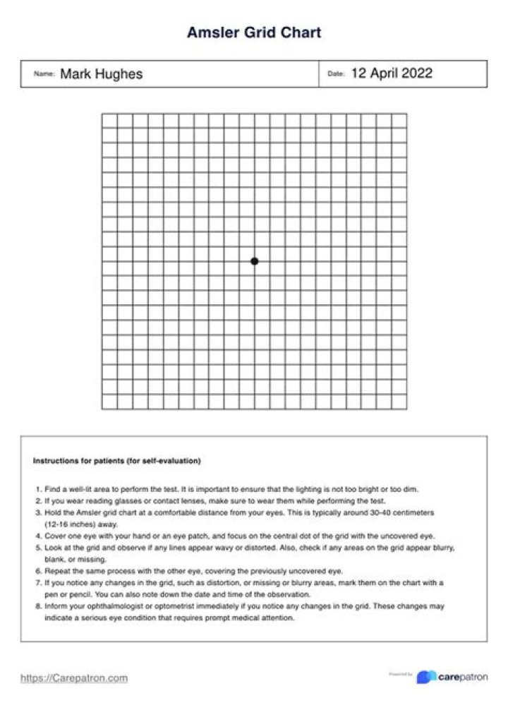 What is Amsler grid used for?