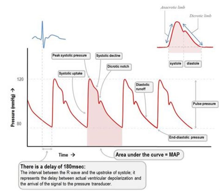 What is the Dicrotic notch in a arterial pulse curve?
